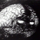 Illustration for article titled Mental Notes: A Cranial Experience from PyramidHeadcrab